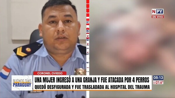 Mujer quedó desfigurada tras ataque de perros en Coronel Oviedo