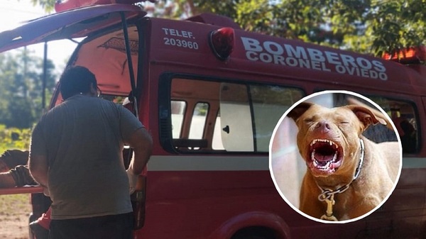 Le amputaron los brazos a la mujer que fue mordida por pitbulls en Coronel Oviedo - Noticiero Paraguay