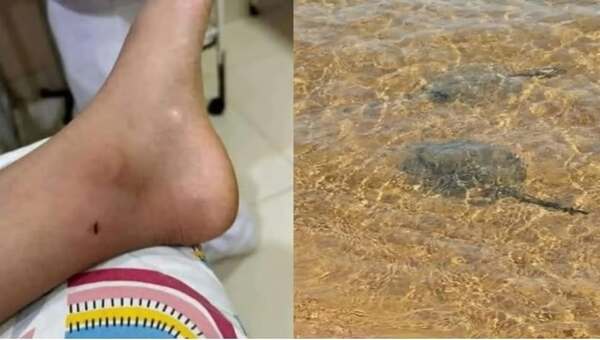 Rayas en la playa San José de Encarnación: menores se encuentran en buen estado