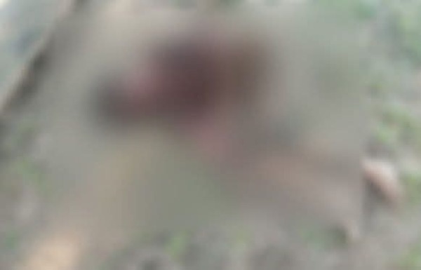 Coronel Oviedo: mujer atacada por pitbulls perdió los dos brazos - 1000 Noticias