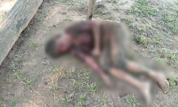 Ataque de pitbull a mujer en Coronel Oviedo: Propietario afirma que su granja es segura para que canes no salgan – Prensa 5