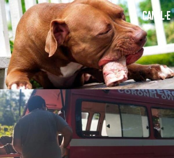 MUJER PERDIÓ SUS DOS BRAZOS TRAS ATAQUE DE PERROS BRAVOS