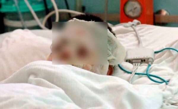 Mujer rocía con nafta y prende fuego a su pareja en Los Cedrales