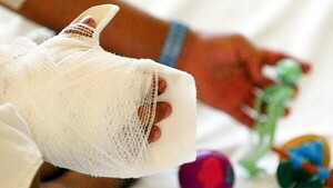 Advierten sobre secuelas permanentes del uso de pirotecnia