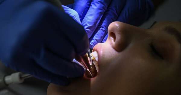 La Nación / Prueban fármaco que podría hacer crecer dientes nuevos