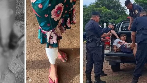 Adicto golpeó a su mamá y hermano