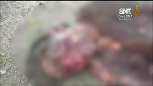 Mujer atacada por perros está en estado crítico - SNT