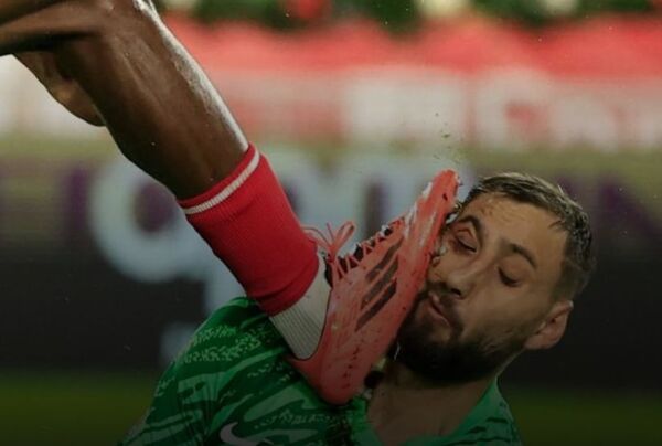 Donnarumma sufrió impactante agresión: salió con su cara ensangrentada