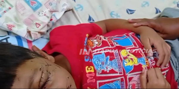 NIÑO DE 5 AÑOS HABRÍA SIDO ATACADO BRUTALMENTE POR UN PERRO - Itapúa Noticias