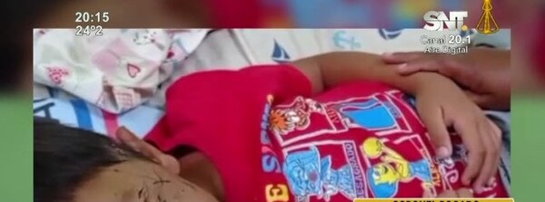 Niño fue atacado por un perro - SNT
