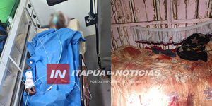 INVESTIGAN CASO DE HOMBRE BALEADO CON ESCOPETA EN CARLOS A. LÓPEZ - Itapúa Noticias
