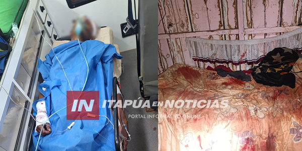 INVESTIGAN CASO DE HOMBRE BALEADO CON ESCOPETA EN CARLOS A. LÓPEZ - Itapúa Noticias