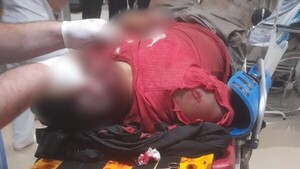 Motociclista se accidentó y terminó preso por una orden de captura pendiente