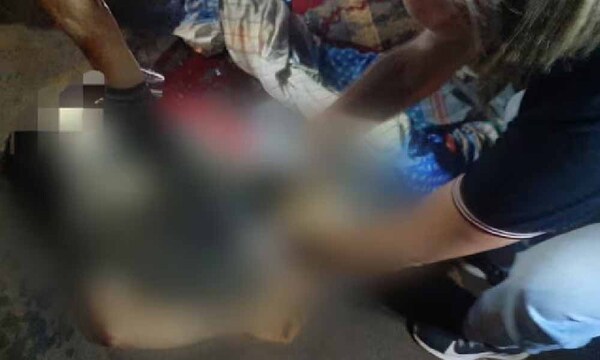 Hombre muere arrollado en la ruta: autor decidió huir tras el choque – Prensa 5