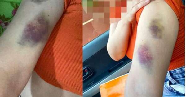 La Nación / Fiscala imputó a hombre alcoholizado que golpeó con violencia a su pareja
