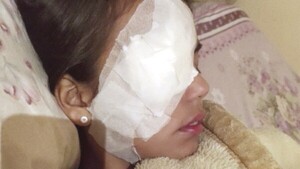 Casi perdió el ojo por petardo