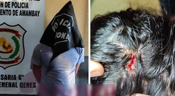 Preso por por agredir verbal y físicamente a su hermana