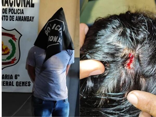 Joven derramó cerveza a su hermana y le reventó la botella en la cabeza