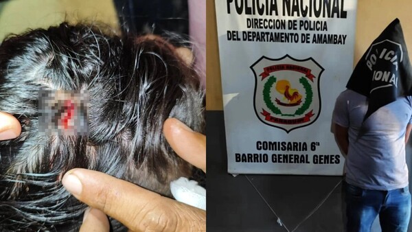 Borracho rompió una botella de vidrio por la cabeza de su hermana