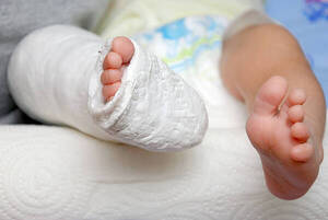 Hieren a beba de 10 meses con pistola de hidrogel