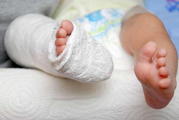 Hieren a beba de 10 meses con pistola de hidrogel