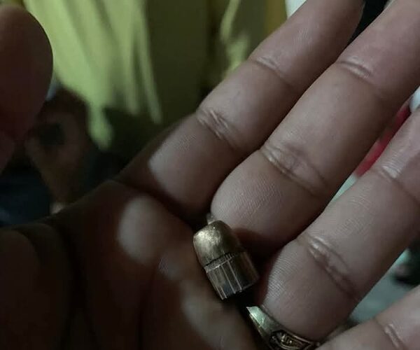Bala perdida hirió a una mujer