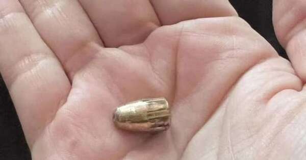 La Nación / Mujer fue alcanzada por una bala perdida en Yaguarón