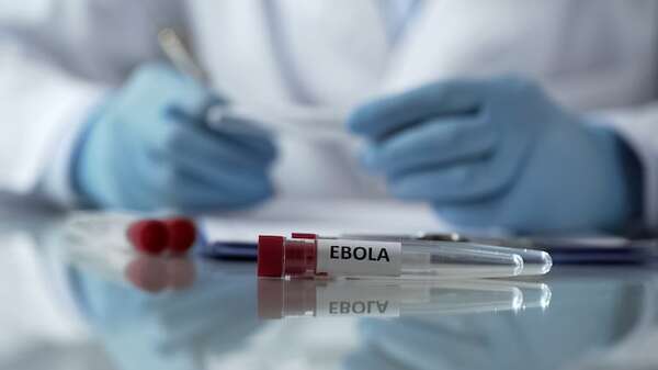 Científicos estadounidenses rastrearon cómo llega el ébola a la superficie de la piel - Ciencia - ABC Color