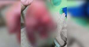 Diario HOY | Itapúa: amputan parte del dedo a niño de 8 años tras sufrir explosión de petardo