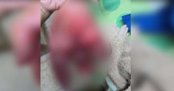 Diario HOY | Itapúa: amputan parte del dedo a niño de 8 años tras sufrir explosión de petardo