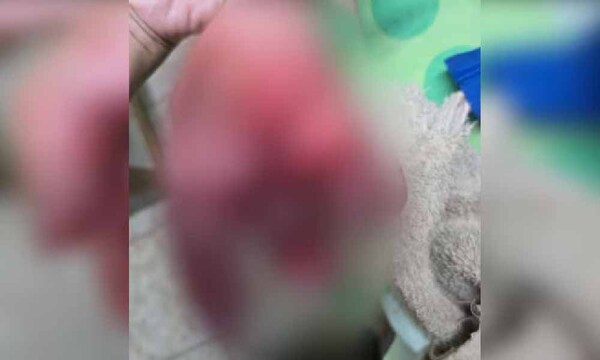 Itapúa: amputan parte del dedo a niño de 8 años tras sufrir explosión de petardo – Prensa 5