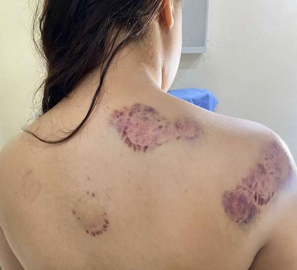Hombre con prisión preventiva tras agresión física a su pareja en Luque - Policiales - ABC Color
