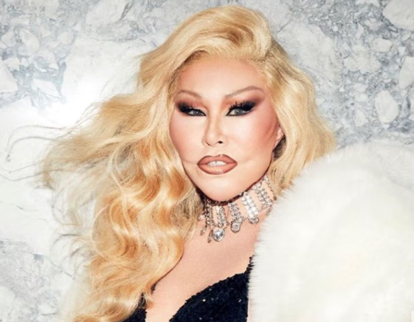 Fallece Jocelyn Wildenstein, conocida como ‘Catwoman’ por sus cirugías estéticas