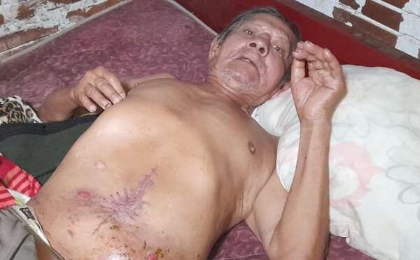 En la ciudad del vicepresidente Pedro Alliana, un adulto mayor vive abandonado y sin atención de salud - Nacionales - ABC Color