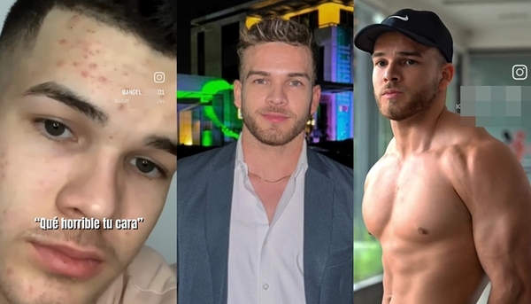 Tras fuerte ciberbullying, influencer mostró su cambio físico - Teleshow
