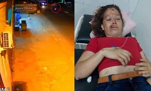 Coronel Oviedo: Mujer fue atropellada por un automóvil y necesita ayuda para operarse – Prensa 5