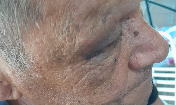 Anciano de 69 años es brutalmente agredido por sus propios hijos en Coronel Oviedo - OviedoPress