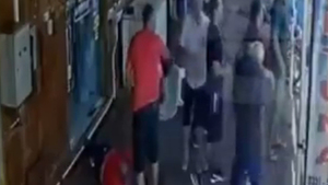 Hombre con discapacidad sufre cobarde agresión en Concepción - SNT