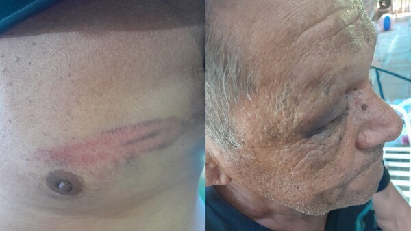 Golpean y roban a su propio papá para comprar drogas