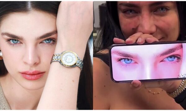 (VIDEO) ¡Locura! Una mujer se operó para tener el mismo color de ojo de Nadia Ferreira