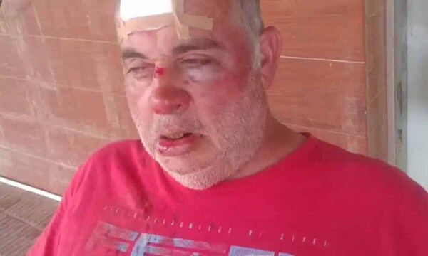 Concepción: Violenta agresión contra sexagenario que registrada en circuito cerrado – Prensa 5
