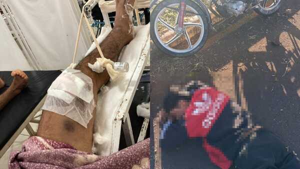 Joven sufre graves lesiones en accidente de tránsito y piden ayuda para su recuperación
