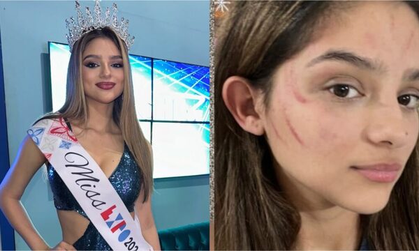 (VIDEO) ¡Miss Expo denuncia haber sido agredida por su vecino y amenazada de muerte!