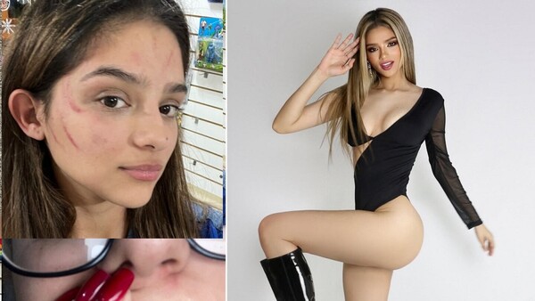 Miss EXPO denunció que fue garroteada por sus vecinos