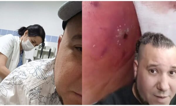 (VIDEO) ¡Ndetavyonde! Una araña mandó al hospital a José Ayala
