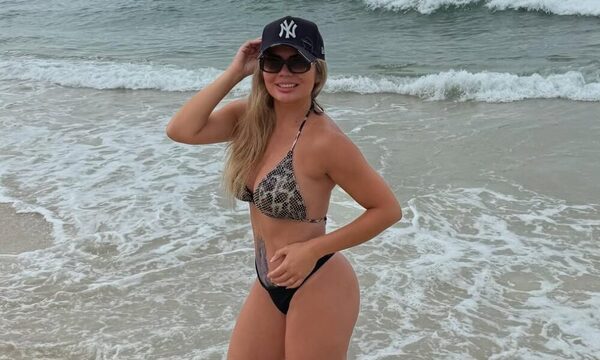 Después de sus vacaciones, Dahiana Bresanovich notó algo raro en su piel: “Hay que tener cuidado”