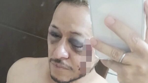 Compatriota fue golpeado en Camboriú por su orientación sexual