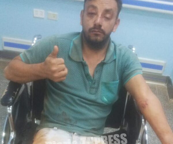 Travestis dieron una paliza, acuchillaron y despojaron de sus pertenencias a un hombre – Diario TNPRESS