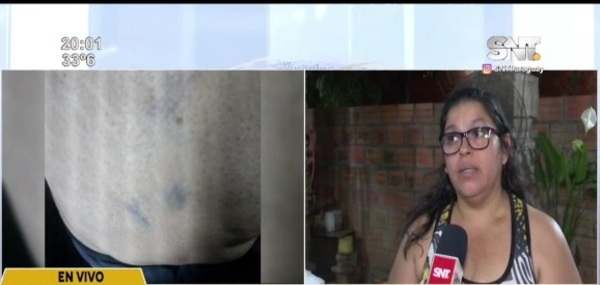 Funcionarios de SEME denuncian agresión - SNT