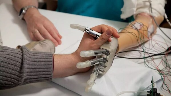 Una mano biónica y estimulación cerebral logran el tacto artificial más real hasta ahora